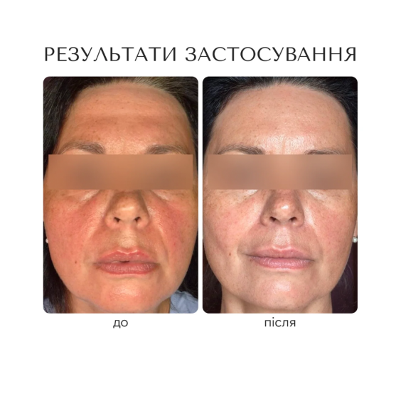 результат застосування